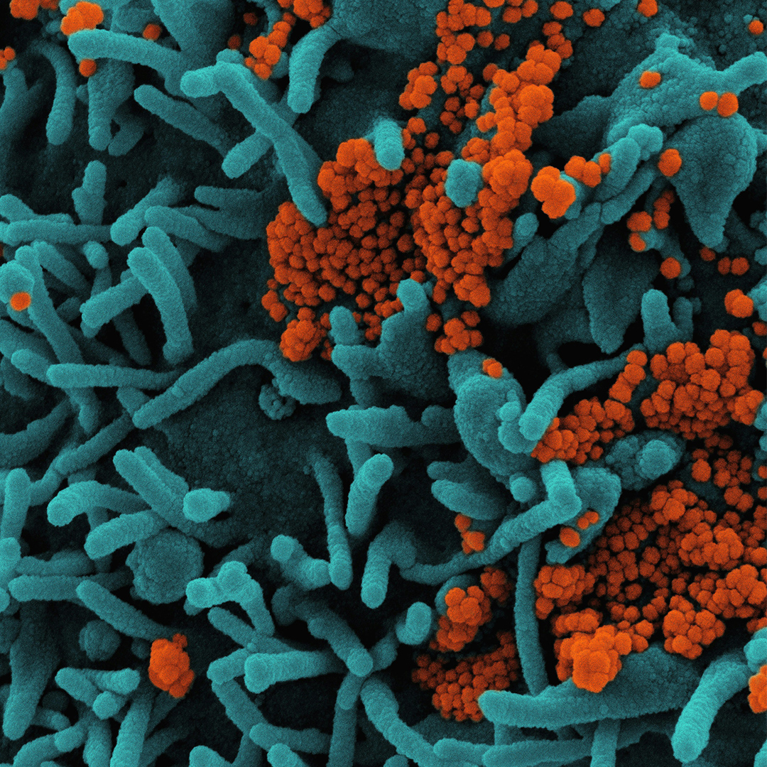 pathogenSQ